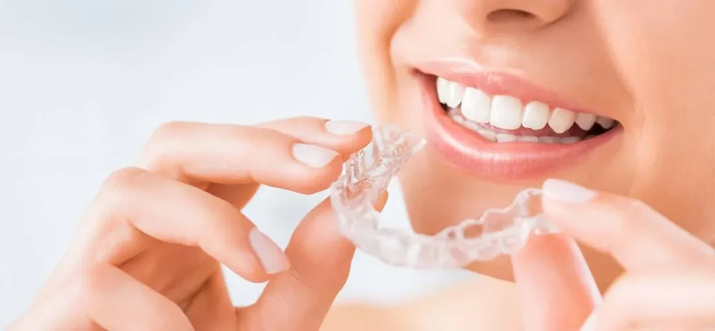 how long do you have to wear a retainer - Eromee | Trending News, Tech & Lifestyle Updates how long do you have to wear a retainer