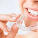 how long do you have to wear a retainer